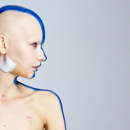 Pasauli iedvesmo modele no Latvijas ar izņemtu žokli