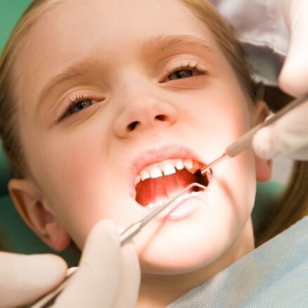 Noderīgi fakti, kas jāzina par zobu kariesu