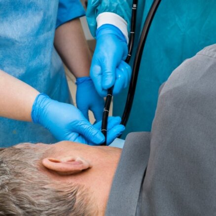 Latvijā pirmoreiz kuņģa vēzi izoperē caur muti endoskopijas laikā