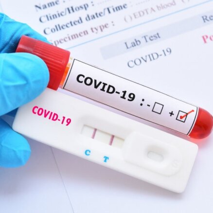 Svētdien konstatēti 3616 jauni Covid-19 infekcijas gadījumi; deviņi cilvēki miruši