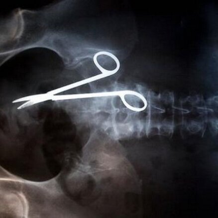 40 unikāli foto ar ļoti dīvainiem rentgenuzņēmumiem