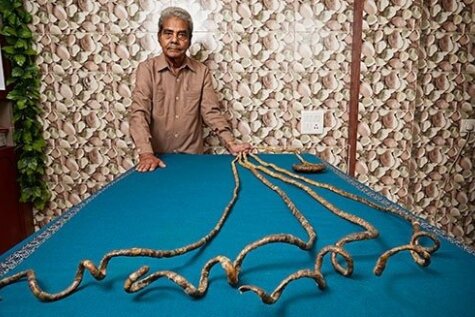 Vīrietis 63 gadu laikā izaudzējis 9 metrus garus nagus