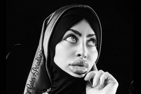 Afgāņu musulmaniete lepojas ar milzīgām silikona lūpām