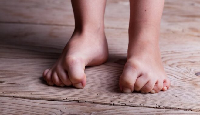 Боль роста. Почему у детей неожиданно болят ноги и что с этим делать