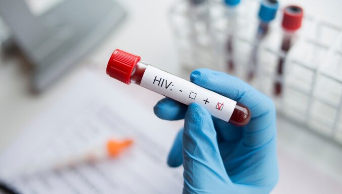 Nīderlandē atklāts ļoti virulents HIV paveids
