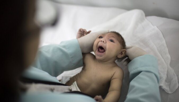 В Испании родился первый в Европе ребенок с микроцефалией из-за вируса Зика