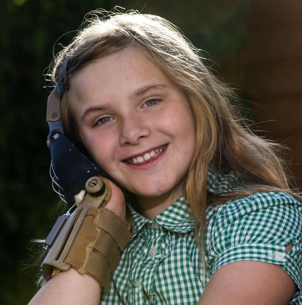 Astoņus gadus vecai meitenei ar 3D printeri izdrukā jaunu roku