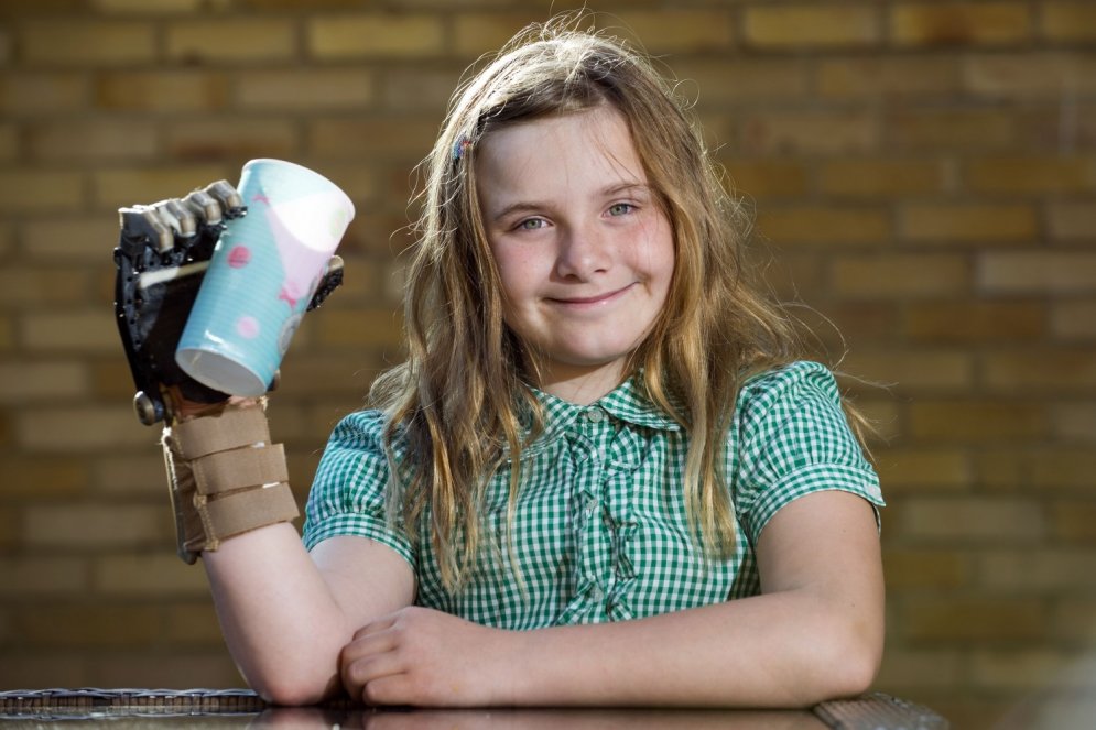 Astoņus gadus vecai meitenei ar 3D printeri izdrukā jaunu roku