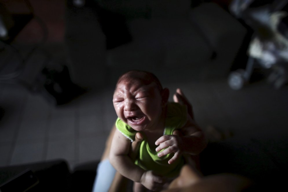 Mazulis, kurš pirms dzimšanas bija inficēts ar Zikas vīrusu