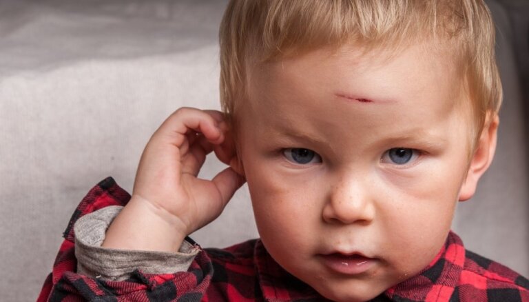 С каждым годом в больницы Латвии попадает все больше детей с травмами